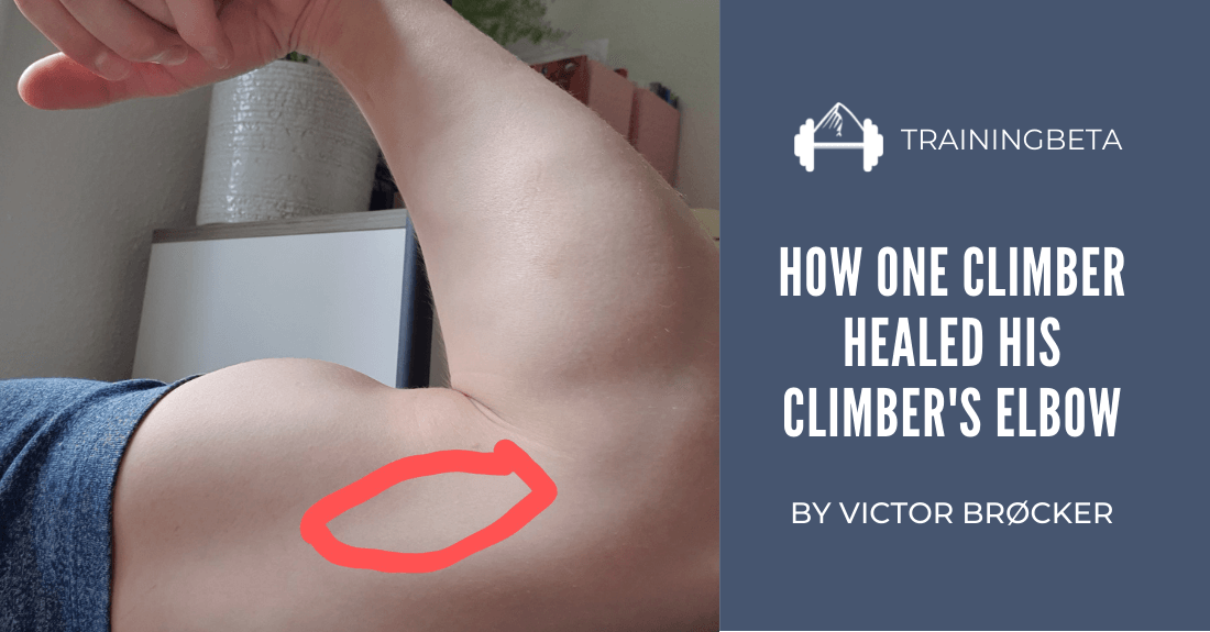 One Climber s Success with Climber s Elbow TrainingBeta